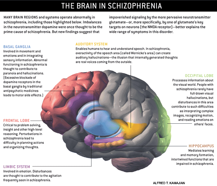 The Brain in Schizopohrenia